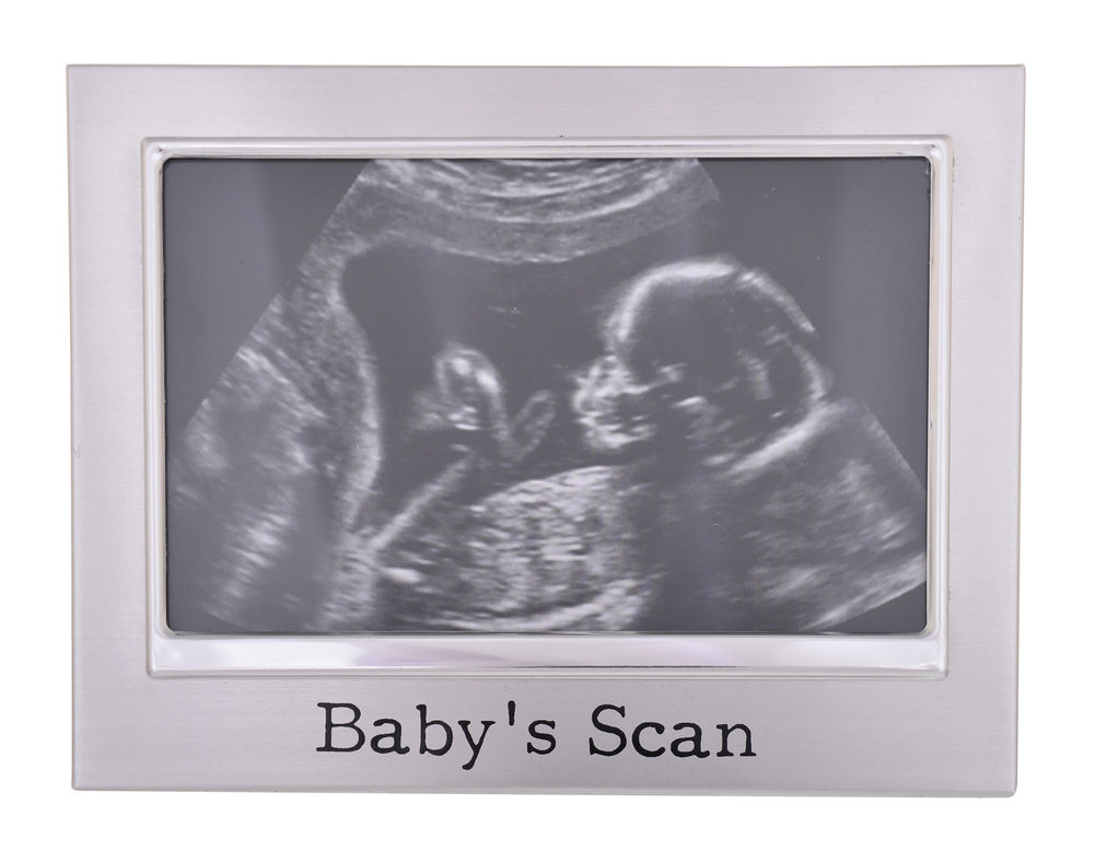 [26475] BABY SCAN FRAME 6X4